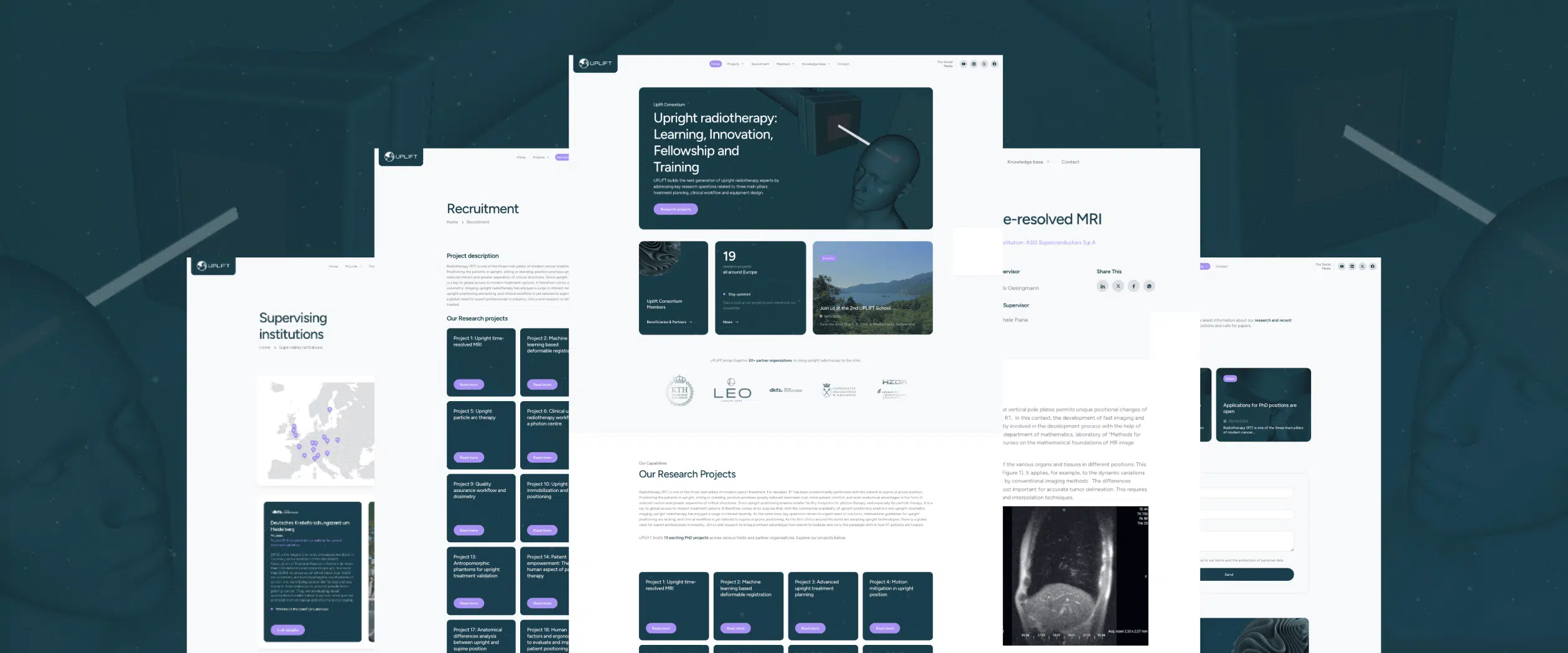 Uplift Full Framebit